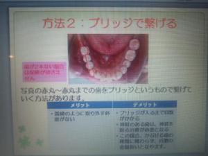 DSC_1505_convert_20121019065953s