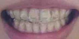 fc2blog_2017121723021128es