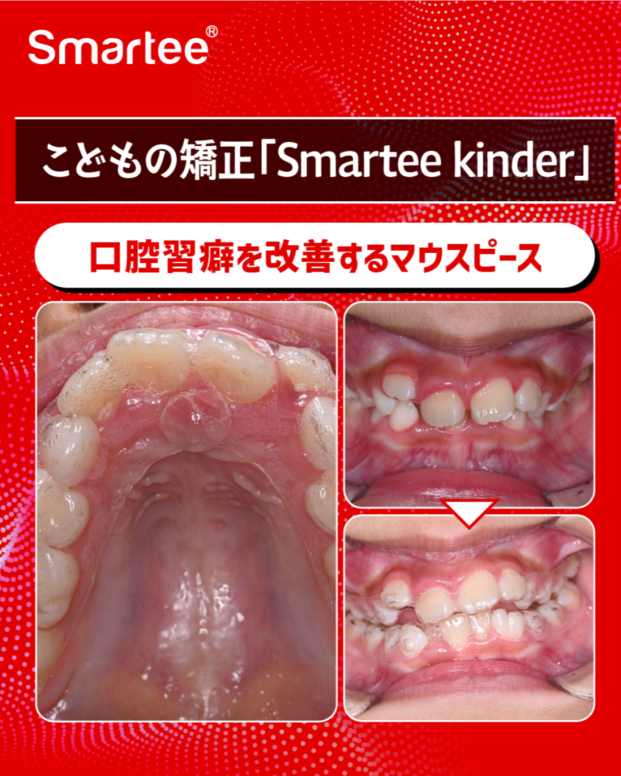 グラフィックス4