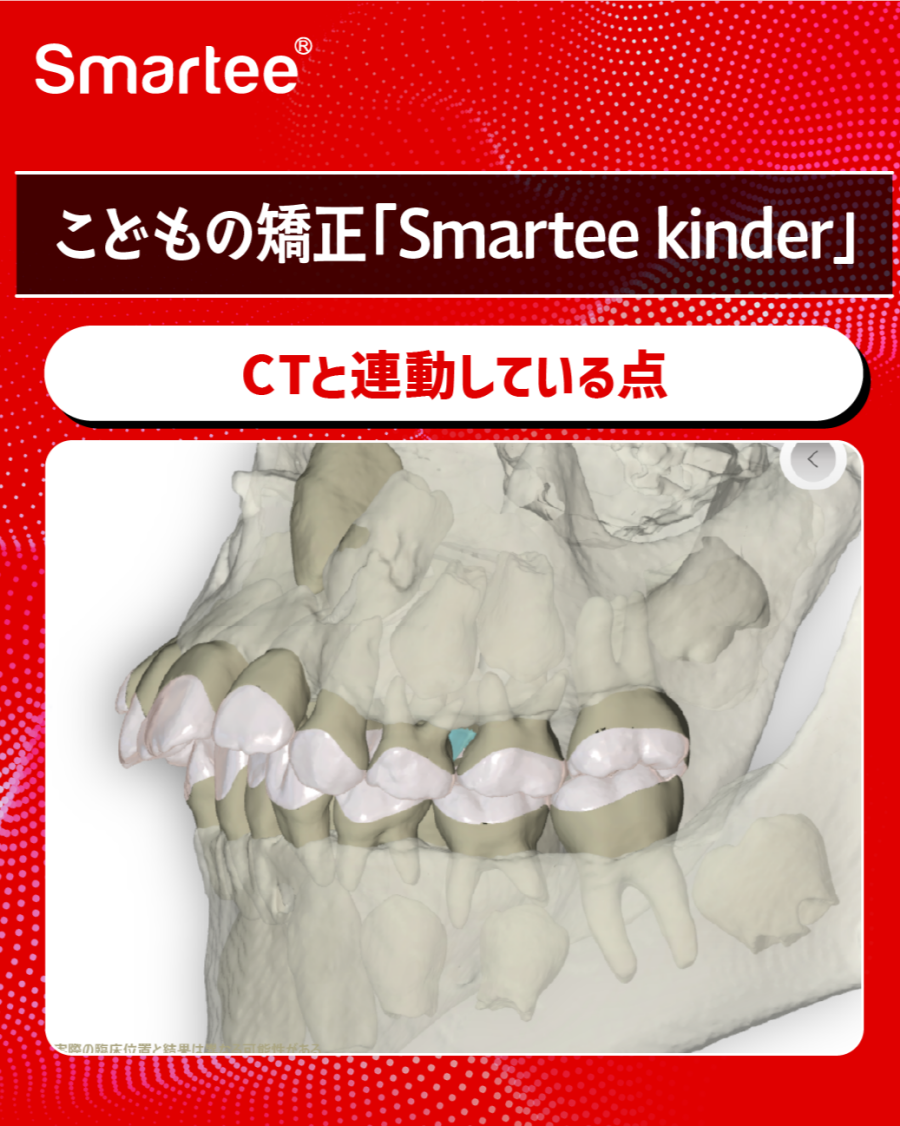 グラフィックス5