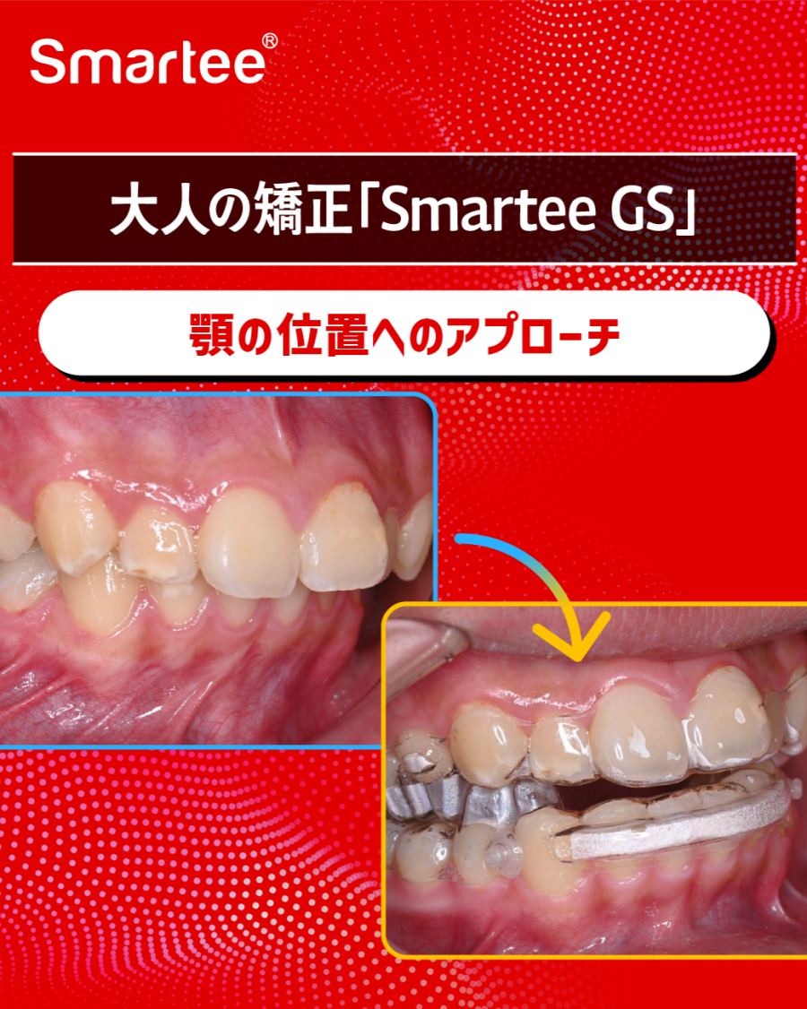 グラフィックス6