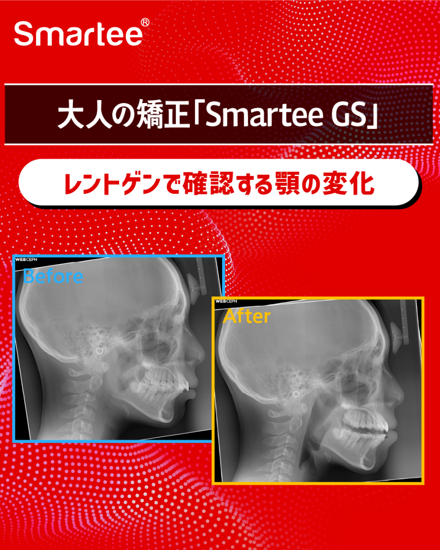 グラフィックス9