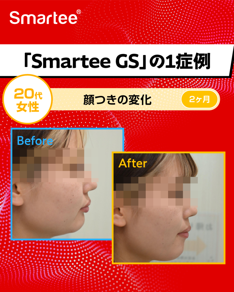 グラフィックス10