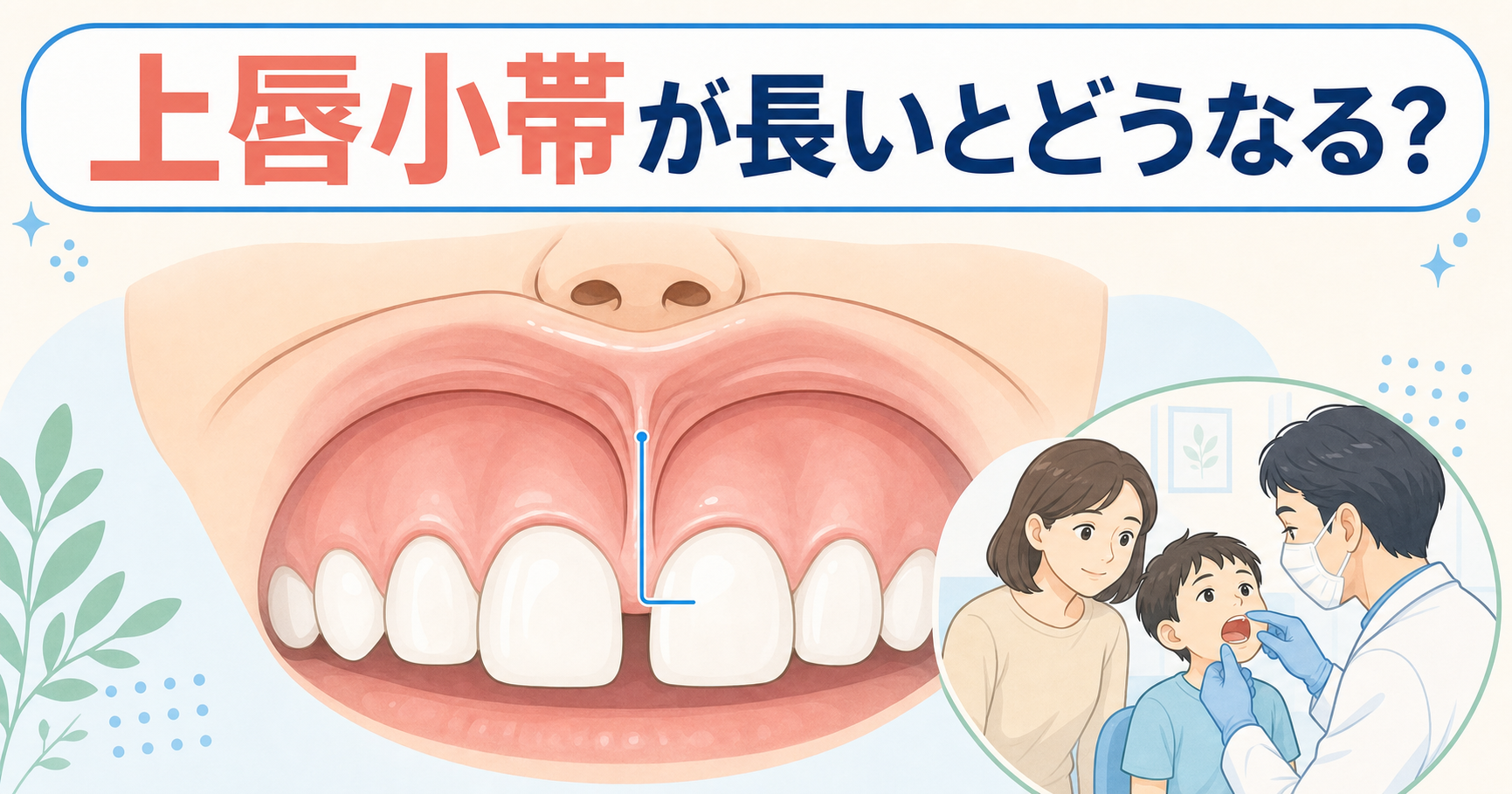 19_上唇小帯が長い
